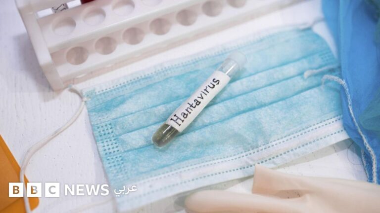 فيروس هانتا: تهديد صحي عالمي يستدعي اليقظة والبحث الدائم