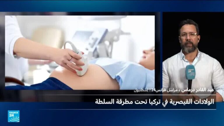 توقيف 100 طبيب بتركيا يثير جدلاً واسعاً بسبب ارتفاع الولادات القيصرية