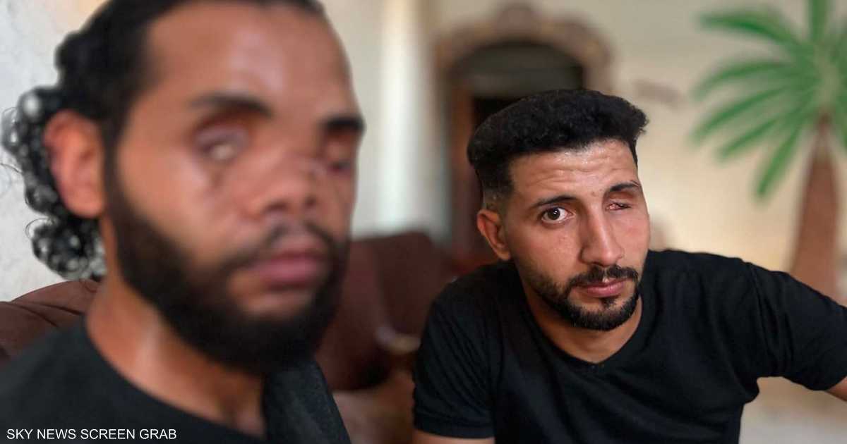 عام من الظلام والألم.. شقيقان من غزة ينتظران العلاج بعد إصاباتهما في القصف الإسرائيلي