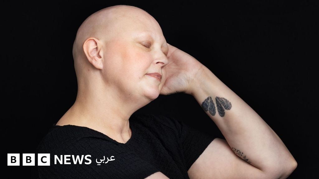 فقدان الشعر خلال العلاج الكيميائي ليس هويتي بل رمز لقوتي: قصص نساء يتحدين السرطان