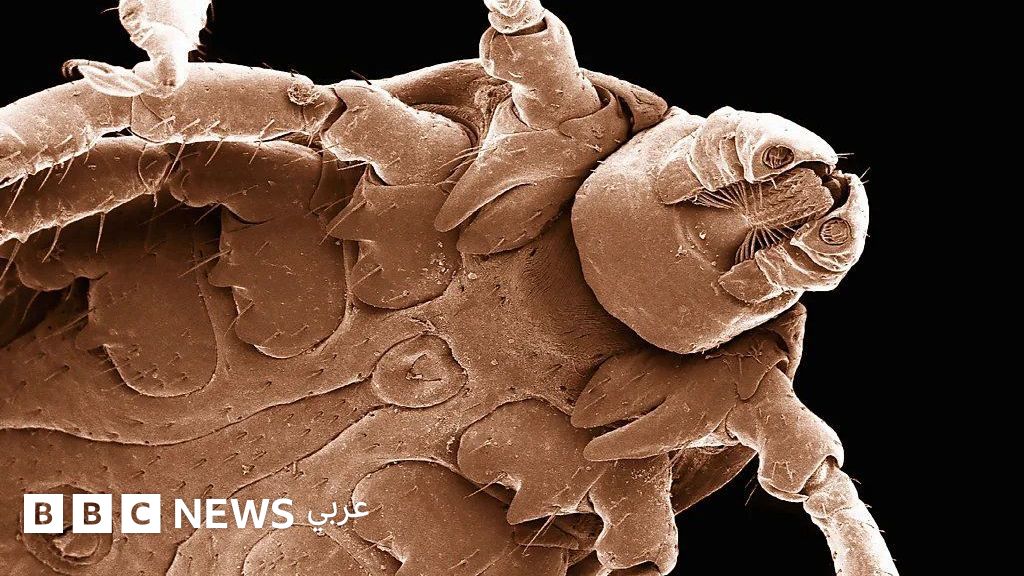 تطورات جديدة في الوقاية من مرض لايم الناتج عن لدغات القراد
