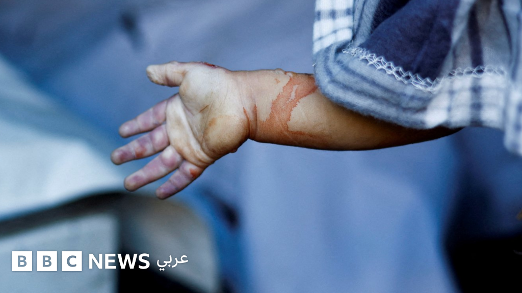 مقتل 21 شخصًا إثر انهيار مبنى يضم نازحين في غزة جراء قصف سابق