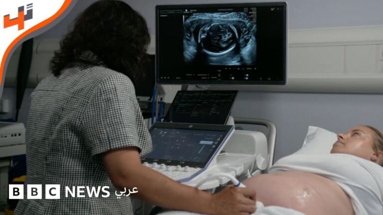 الذكاء الاصطناعي يعزز دقة فحوصات الموجات فوق الصوتية للجنين