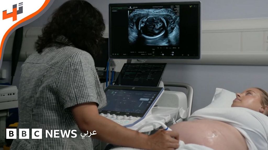 الذكاء الاصطناعي يعزز دقة فحوصات الموجات فوق الصوتية للجنين