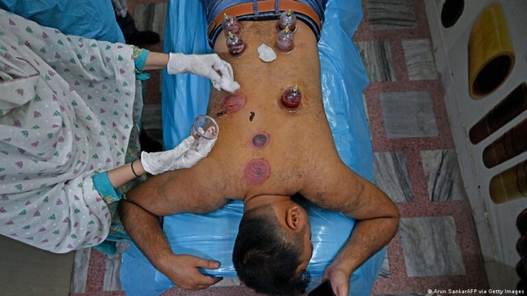 الحجامة بين الواقع والادعاء: ما مدى فعاليتها في علاج الآلام والأمراض المزمنة؟