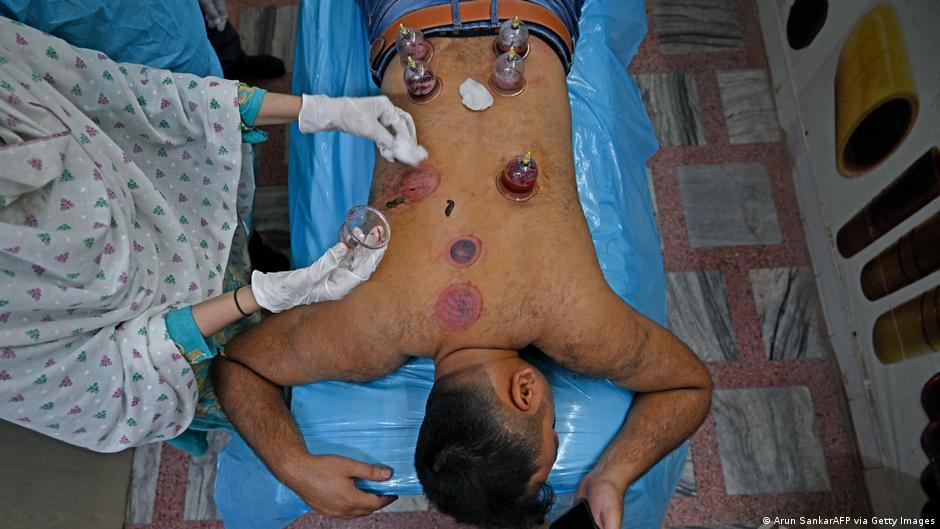 الحجامة بين الواقع والادعاء: ما مدى فعاليتها في علاج الآلام والأمراض المزمنة؟