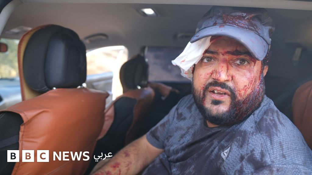 اندلاع مواجهات في الضفة الغربية خلال موسم حصاد الزيتون وإصابة فلسطينيين وصحفية أمريكية